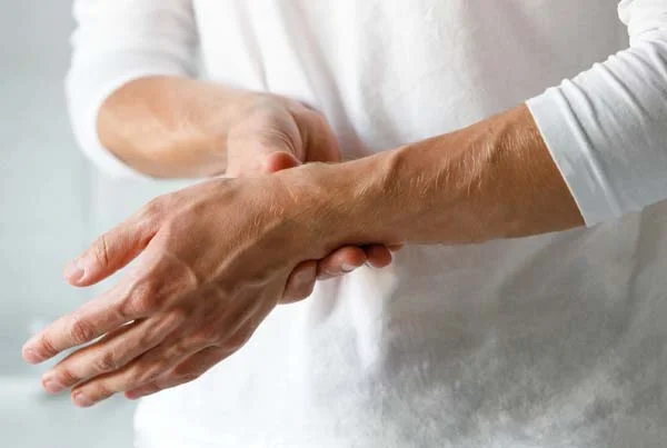 Arthritis Management