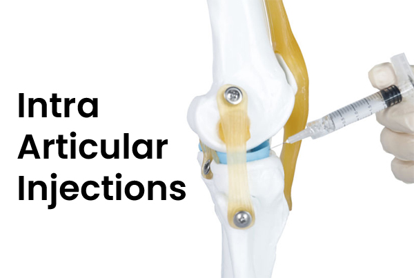 Intra Articular Injections