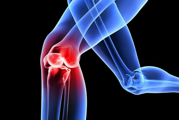 Infection in Orthopaedics
