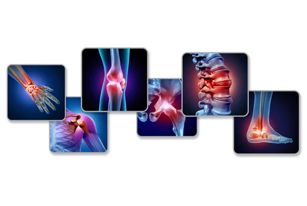 Preventive Orthopaedics